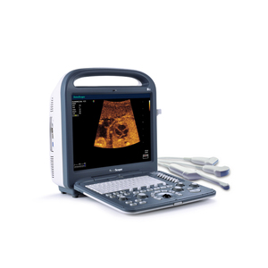 Giá Máy Siêu Âm Sonosape S2/Doppler Màu - Product Image 1
