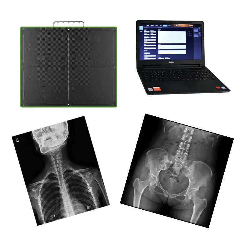 Detector de máquina de raio x, sem fio, painel médico portátil digital 17*17