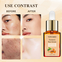 Vente en gros OEM Naturel Taches de rousseur Éclat Pigmentation de la peau Végétalien Blanchiment du visage Taches brunes du visage Élimination de l'acné Vitamine C Sérum au curcuma