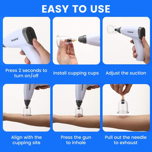 Hot Selling 12-teiliges hochwertiges elektrisches Vakuum-Schröpf gerät Gutes Hijama-Schröpfset für Körper, geeignet mit Schröpf pumpe - Product Image 5