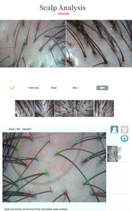 กล้องส่องผิวหน้าแบบพกพาอัจฉริยะ กำลังขยาย 50 เท่า วัดความชุ่มชื้นและรูขุมขน สินค้าขายดี มาใหม่ ผู้จัดจำหน่ายอันดับต้นๆ ปี 2026 เครื่องตรวจจับ 3-in-1 รุ่นใหม่ - Product Image 5