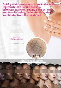 Blanqueamiento para Piel Asiática, Suero y Loción, para Blanqueamiento de Zonas Íntimas, Canal Mayorista de Fábrica de Cosméticos - Product Image 2