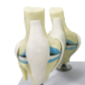ADA <b>Medical</b> Teaching Pathological Shoulder Joint <b>Model</b> and Knee Health Morbidity Comparison <b>Model</b> with Hip Health Morbidity - Product Image 6