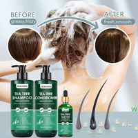 Set de Cuidado Capilar Antifúngico de Marca Privada, Crema para el Cuero Cabelludo, Tratamiento Anticaspa para Cabello Graso y Dermatitis Seborreica, Proveedor al por Mayor