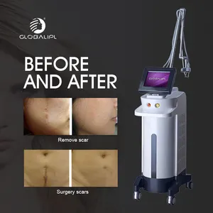 Global ipl Women Medical Equipment Fractional Co2 Laser Vaginal straffung maschine