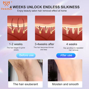 Épilation Ulik IPL pour femmes et hommes Épilation IPL pour des résultats presque indolores et durables - Product Image 3