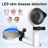 Dermatoscope portable à lumière LED UVA pour le corps, lampe à bois ABS, analyseur cutané pour Vitiligo, Psoriasis, Eczéma, type savon