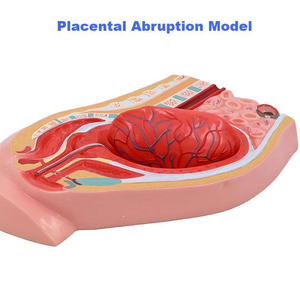 Nữ bụng-xương chậu sagittal phần Mô hình giải phẫu sau sinh mô phỏng tách nhau thai thiết bị giáo dục PVC - Product Image 4