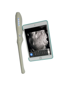 Transvaginale Array <span class=keywords><strong>Endocavity</strong></span> Ultrasone Draadloze Ultrasound <span class=keywords><strong>Probe</strong></span> - Product Image 3