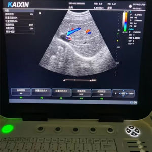 Échographe Doppler portable de haute qualité pour animaux Sonoscape, <span class=keywords><strong>scanner</strong></span> à ultrasons pour animaux de compagnie, échographe Doppler couleur vétérinaire, <span class=keywords><strong>prix</strong></span> - Product Image 5