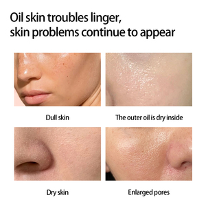 Wholesale Natural Lightening Vitamin <strong>C</strong>/E/B3 Salicylic Acid Hyaluronic Acid for Tea Tree 30ml Healing Moisturizing Soothing - Product Image 3