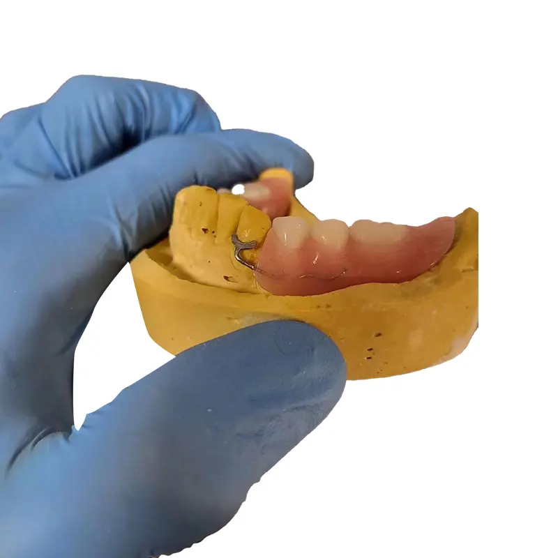 歯科医院歯科矯正0.8mm 0.9mmクラスプローチロッデン