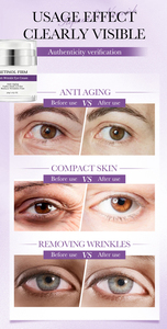 <span class=keywords><strong>Crema</strong></span> Contorno de Ojos <span class=keywords><strong>Antiarrugas</strong></span> de Marca Privada, Elimina Bolsas y Ojeras, Reduce la Hinchazón, con Retinol - Product Image 3