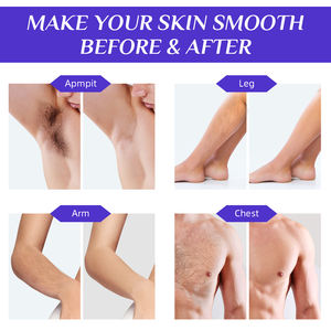 Waxkiss 500ml 왁싱 냄비 히터 키트 제모 제모 전기 왁스 히터 여성과 남성 제모 - Product Image 2