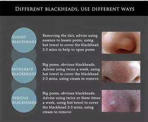 OEM <span class=keywords><strong>BIOAQUA</strong></span>, venta al por mayor, eliminación de espinillas personalizada, limpieza facial, control de aceite, productos de belleza para el cuidado de la piel, removedor de espinillas, máscara de barro - Product Image 3