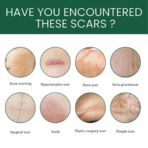 4cm * 150cm Confortable Respirant Sécurité Plâtre Chinois Cicatrice Silicone Cicatrice Feuilles - Product Image 6