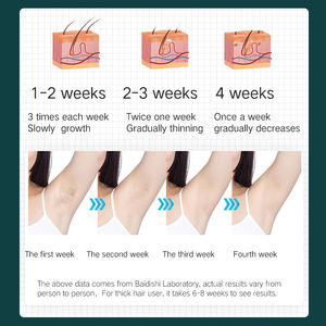 PAKISS em جهاز إزالة دائم محمول للمنزل oiss جهاز إزالة الوجه للجسم - Product Image 4