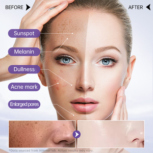 <span class=keywords><strong>Crème</strong></span> <span class=keywords><strong>Visage</strong></span> Anti-rides et Anti-taches Hydratante Nourrissante au Glutathion Effet Blanchissant Marque Blanche - Product Image 5