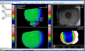 Equipo Oftalmológico de Alta Calidad SW-6000 Topografía Corneal - Product Image 5