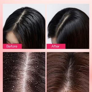 Gommage capillaire OEM éliminant les accumulations, exfoliant, lissant, nettoyant en profondeur, au sel rose de l'Himalaya, shampoing-gommage pour cuir chevelu, marque privée - Product Image 6