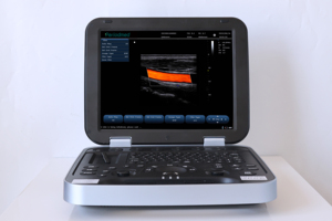 Groothandel goedkoopste kleuren Doppler draagbare echografiemachine 15 inch LCD-scherm laptop echografie scanner voor huisdieren of mensen - Product Image 6