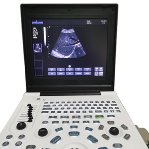 Échographe numérique complet de haute qualité et très demandé pour usage vétérinaire et scanner d'échographie de haute qualité pour vétérinaires - Product Image 4