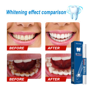 Lápiz Blanqueador Dental de Alta Calidad, Lápiz Limpiador de Manchas Dentales, Lápiz Dental Refrescante y Cuidado - Product Image 2