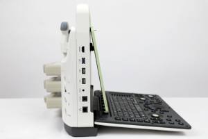 Médico 3D 4d Color <span class=keywords><strong>Doopler</strong></span> 3D Portátil Full Digital Color Cardiaco Doppler Escáner de ultrasonido - Product Image 3