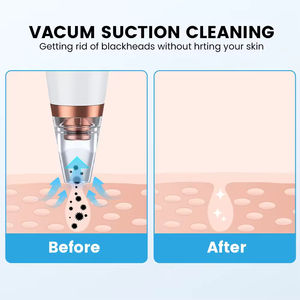 เครื่องมือกำจัดสิวหัวดำระบบไฟฟ้าพร้อมหัว<span class=keywords><strong>ดูด</strong></span>6หัวทำความสะอาดรูขุมข<span class=keywords><strong>น</strong></span>บนใบหน้า3โหมด - Product Image 4