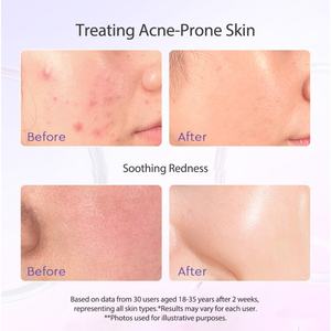 OEM ODM <b>Skin</b> Repair Ance Foaming Centella Face Wash Blueberry Ceramide Low PH Gel Facial <b>Cleanser</b> - Product Image 3