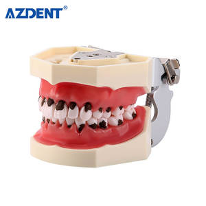 <span class=keywords><strong>Model</strong></span> Pengajaran Gigi Azdent <span class=keywords><strong>Model</strong></span> Kalkulus Gigi/ <span class=keywords><strong>Model</strong></span> Penyakit <span class=keywords><strong>Periodontal</strong></span> - Product Image 2