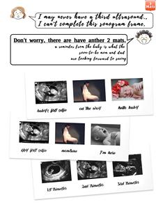 Cadre photo triple pour échographie de bébé, cadeau de fête prénatale pour les futurs parents, décoration de chambre d'enfant - Product Image 3