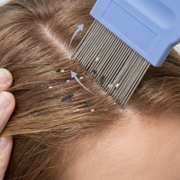 Peigne à poux en acier inoxydable avec aiguilles à rainures spirales, lot de 2, outil professionnel de suppression des lentes pour la famille, brosse pour la vente en gros mondiale