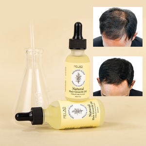 Aceite Nutritivo Botánico para el Cuidado del Cuero Cabelludo de Marca Propia, Aceite NATURAL para el Crecimiento del Cabello, para Cuero Cabelludo Sensible - Product Image 2