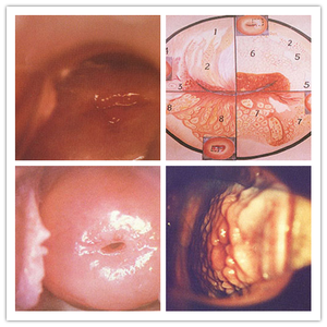 SW-3301 Kolposkop Video Digital Portabel/Pengenalan Kolposkop Portabel/Kolposkop Vagina - Product Image 4