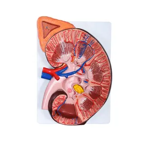 Medical human anatomical kidney model with adrenal gland for teaching kidney model