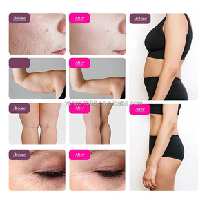 Instrumento de Belleza Multifunción 9 en 1 Comercial, Tecnología de Cavitación Sónica de 80Khz, Máquina de Vacío Negativo - Product Image 6