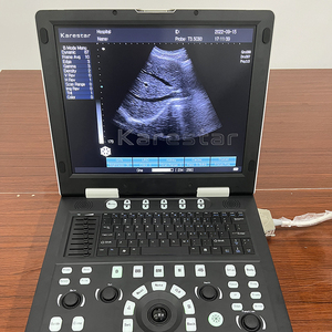 Échographe vétérinaire portable noir et <span class=keywords><strong>blanc</strong></span> pour la gestation animale - Product Image 2