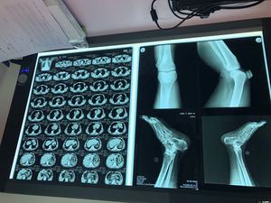 Medical X Ray <span class=keywords><strong>Film</strong></span> Viewer Portable LED <span class=keywords><strong>x-ray</strong></span> <span class=keywords><strong>Film</strong></span> View illuminatore radiografia negatoscopio - Product Image 3