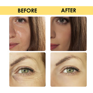 Venta al por mayor hidratante nutritivo cuidado de la piel lámina de oro antienvejecimiento antiarrugas 24K oro niacinamida suero facial - Product Image 3