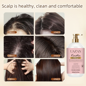 Ensemble <span class=keywords><strong>Shampoing</strong></span> et Après-<span class=keywords><strong>Shampoing</strong></span> Professionnel Anti-Pelliculaire à l'Huile de Batana et Huile de Coco, Favorisant la Croissance Capillaire, Marque Blanche, Vente en Gros pour Femmes - Product Image 5
