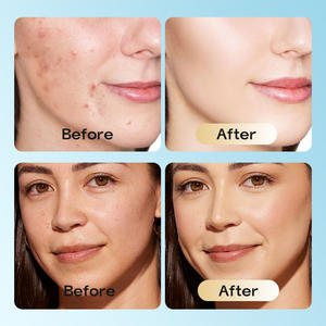 韓国のホワイトニングスキンケア製品アンチエイジング製品フェイスローズヒップシードオイル - Product Image 4