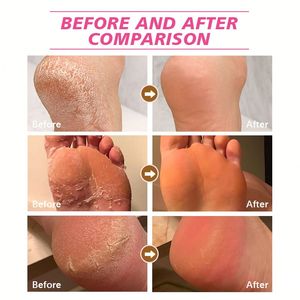Masque exfoliant nourrissant pour les pieds, cadeau de Noël, marque privée, masque exfoliant naturel efficace pour les pieds, masque hydratant pour les pieds - Product Image 6
