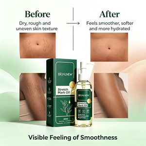 Minyak Tubuh Penghilang <span class=keywords><strong>Stretch</strong></span> <span class=keywords><strong>Mark</strong></span> Private Label, Melembapkan, Memperbaiki Kulit, Minyak Esensial Vitamin E, Retinol, Minyak Bunga Matahari - Product Image 1