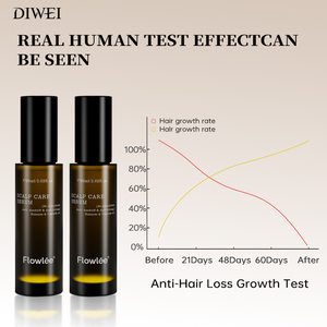 Diwei <span class=keywords><strong>disaar</strong></span> สเปรย์ปลูกผมสำหรับผู้ชายน้ำมันบำรุงผมร่วงยี่ห้อดีเหว่ยสำหรับผู้หญิง - Product Image 5