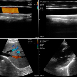 Offer OEM&ODM&SDK Service for Medial Double Head Color Doppler Portable Wireless <b>Handheld</b> Ultrasound Probe <b>Scanner</b> - Product Image 5