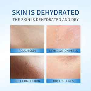 Sérum hydratant à l'acide hyaluronique 72H, hydratation intense, soin du visage bleu pour usage domestique, 30 ml, soin des peaux déshydratées et sèches - Product Image 3