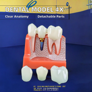 4 volte impianto dentale modello porcellana denti corona rimovibile ponte impiallacciature per la scienza medica studio insegnamento - Product Image 2