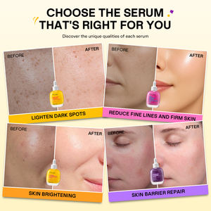 Suero <span class=keywords><strong>Facial</strong></span> <span class=keywords><strong>Iluminador</strong></span> con Vitamina C y Niacinamida, Orgánico, de Alta Calidad, 30 ml, Marca Blanca al por Mayor - Product Image 5