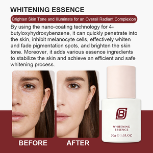 Suero Esencial Blanqueador Facial con Niacinamida y 4-BUTILRESORCINOL, Combate las Manchas Oscuras, Suero Facial Blanqueador de Alta Eficiencia - Product Image 4